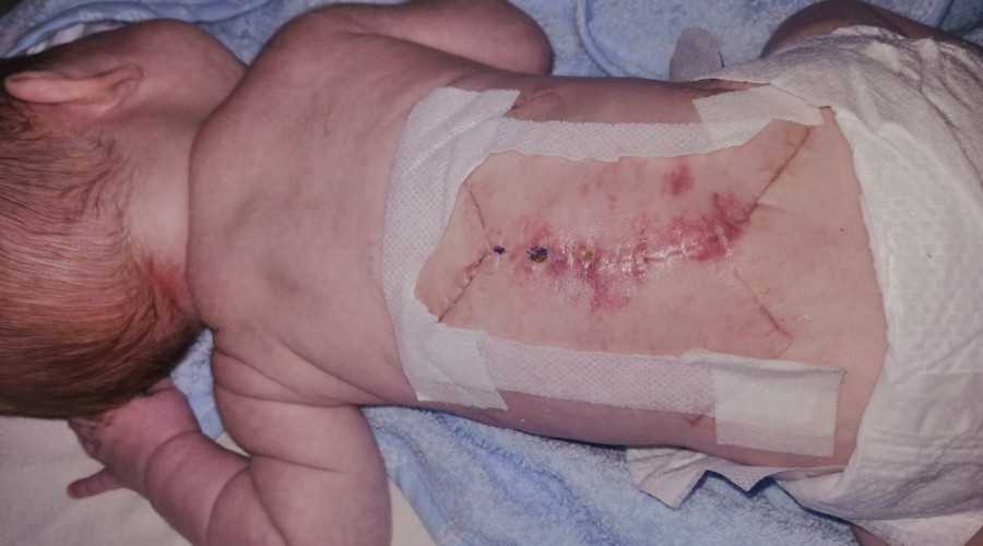 pomoc dla Antosia (6)